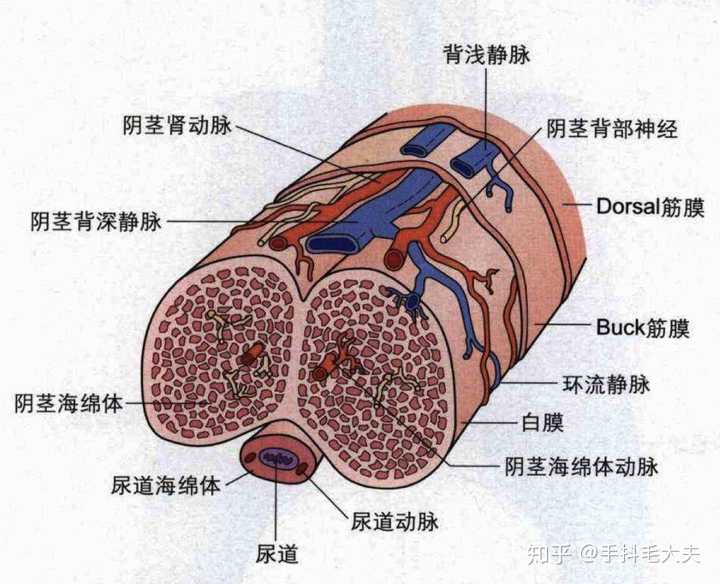 丁丁断裂,学名"阴茎海绵体破裂",有时也被形象地称为"阴茎骨折".