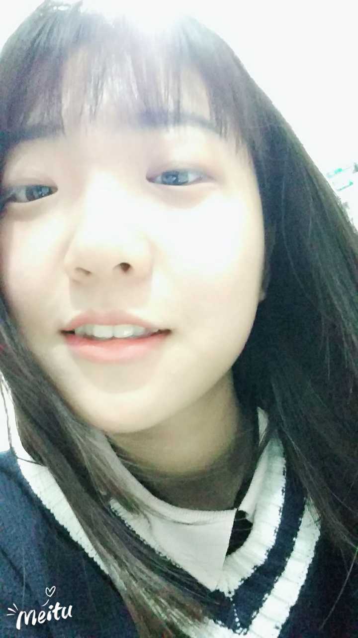 一个人同时长有虎牙和兔牙是什么样的感受?