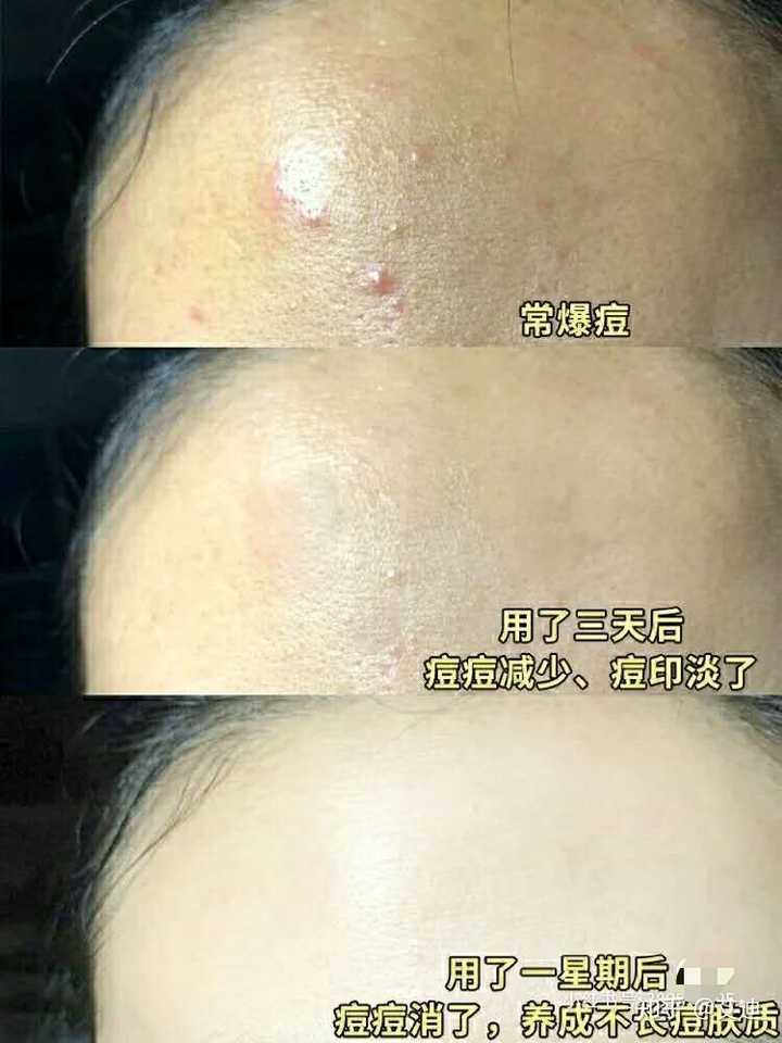 情况简述在下. - 知乎