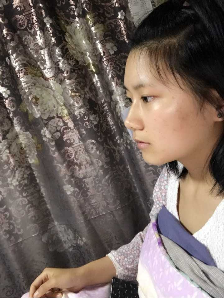 素颜大鼻子侧脸照 . 可以看到眼睛条件和嘴巴 .都是正常水平啊 !