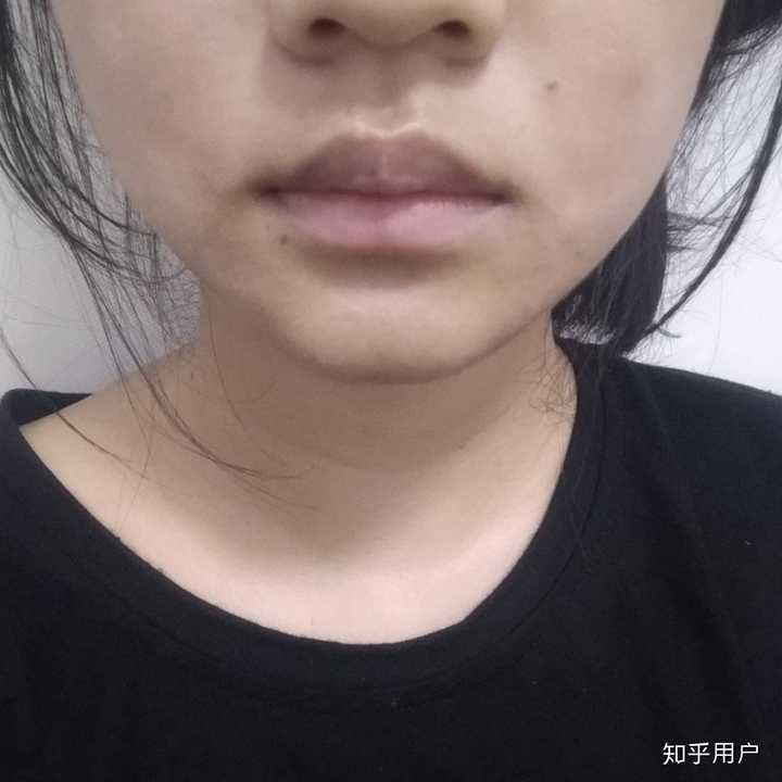 嘴上有颗痣真的会很丑吗?