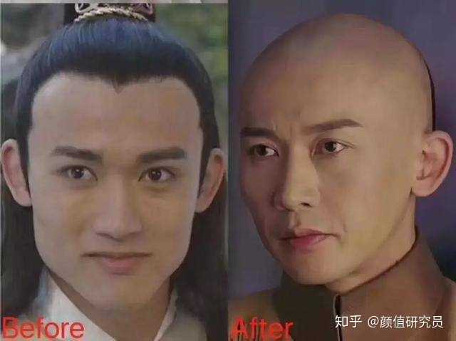为什么女明星整容容易被人发现,而男明星都不太明显?