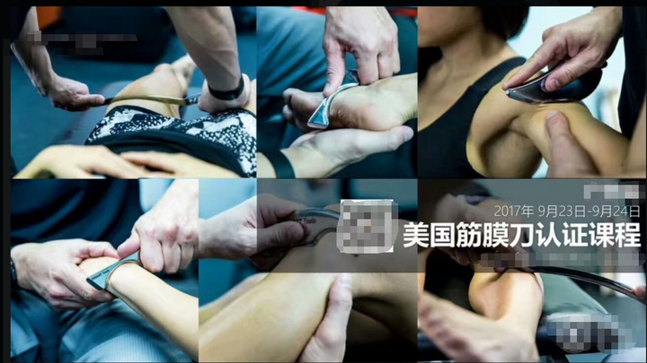 筋膜刀是否属于医疗器械,在我国的药监局有备案许可吗