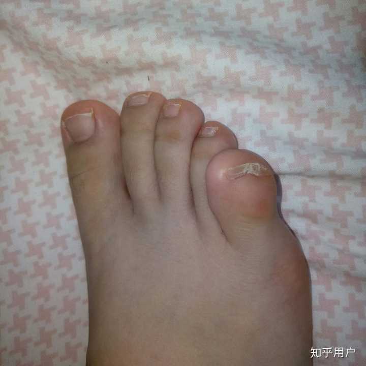 女生脚丑是种什么样的体验?