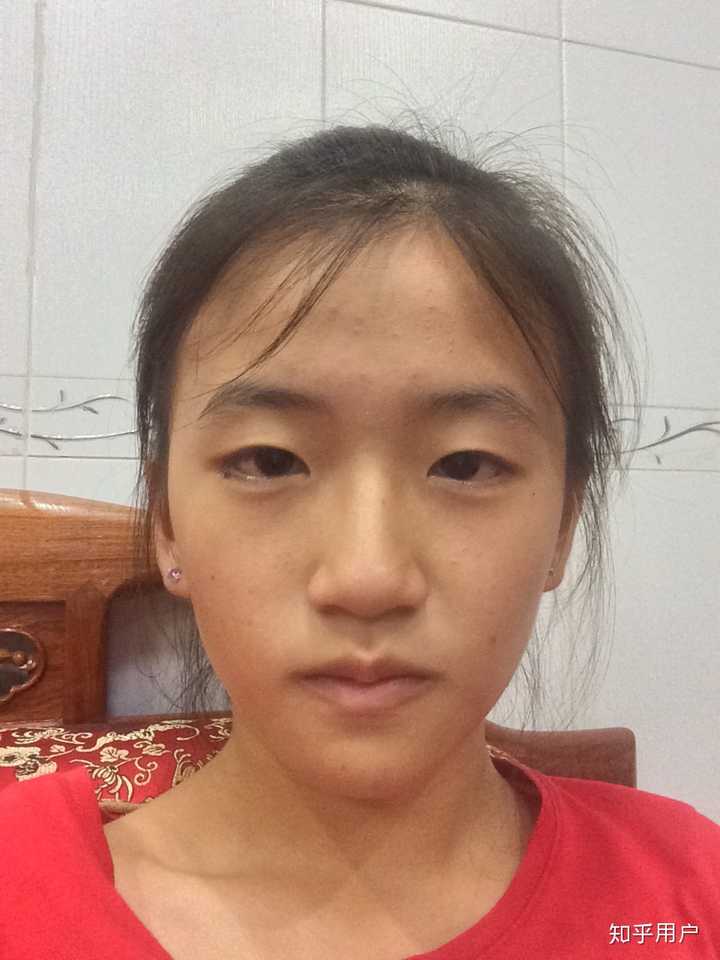 侧脸丑而正脸好看是一种什么体验?