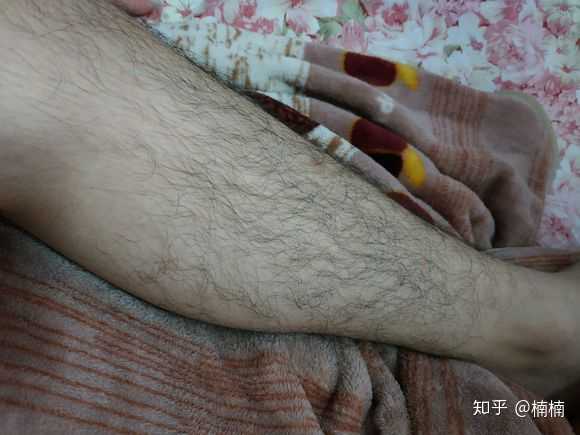 有腿毛的女生可怕,还是有腋毛女生可怕?