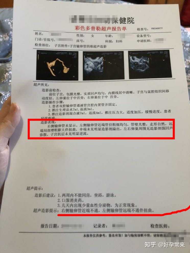 输卵管造影的结果麻烦给看一下之前检测过排卵正常卵巢正常激素六项