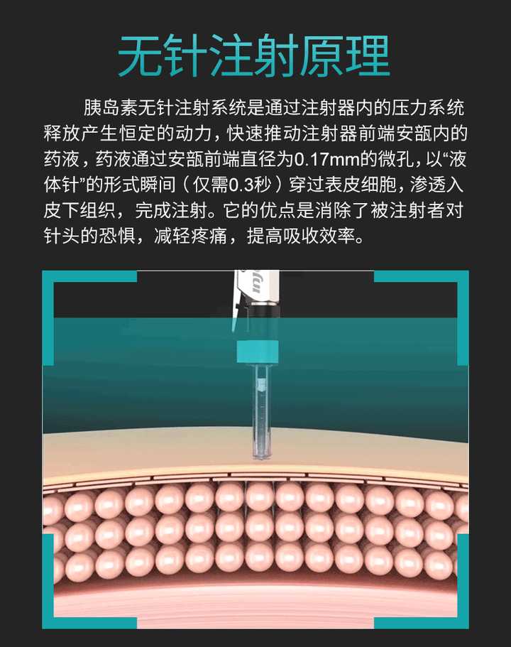 用无针注射器注射胰岛素的话,胰岛素是渗透到皮下吗?