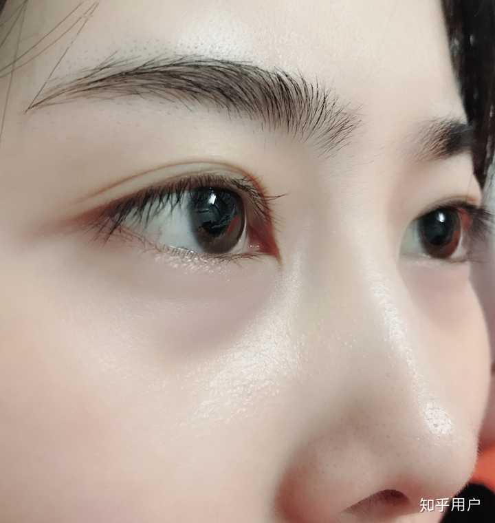 能看出来吗,左眼还好,右眼就时单时双,多层眼皮.
