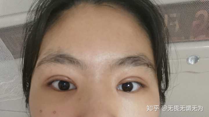 割双眼皮是种怎样的体验?