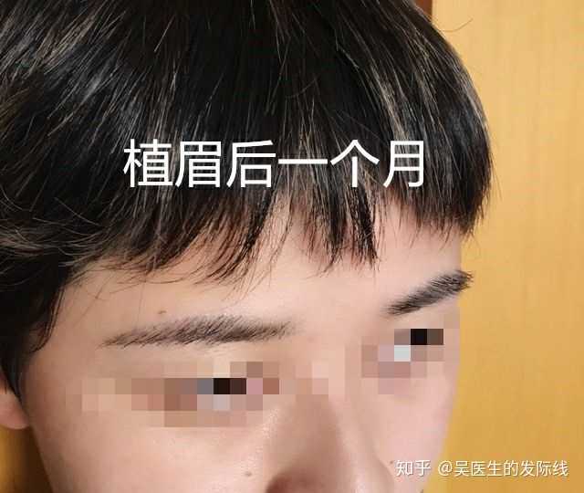 男生这样纹眉合适还是植眉?