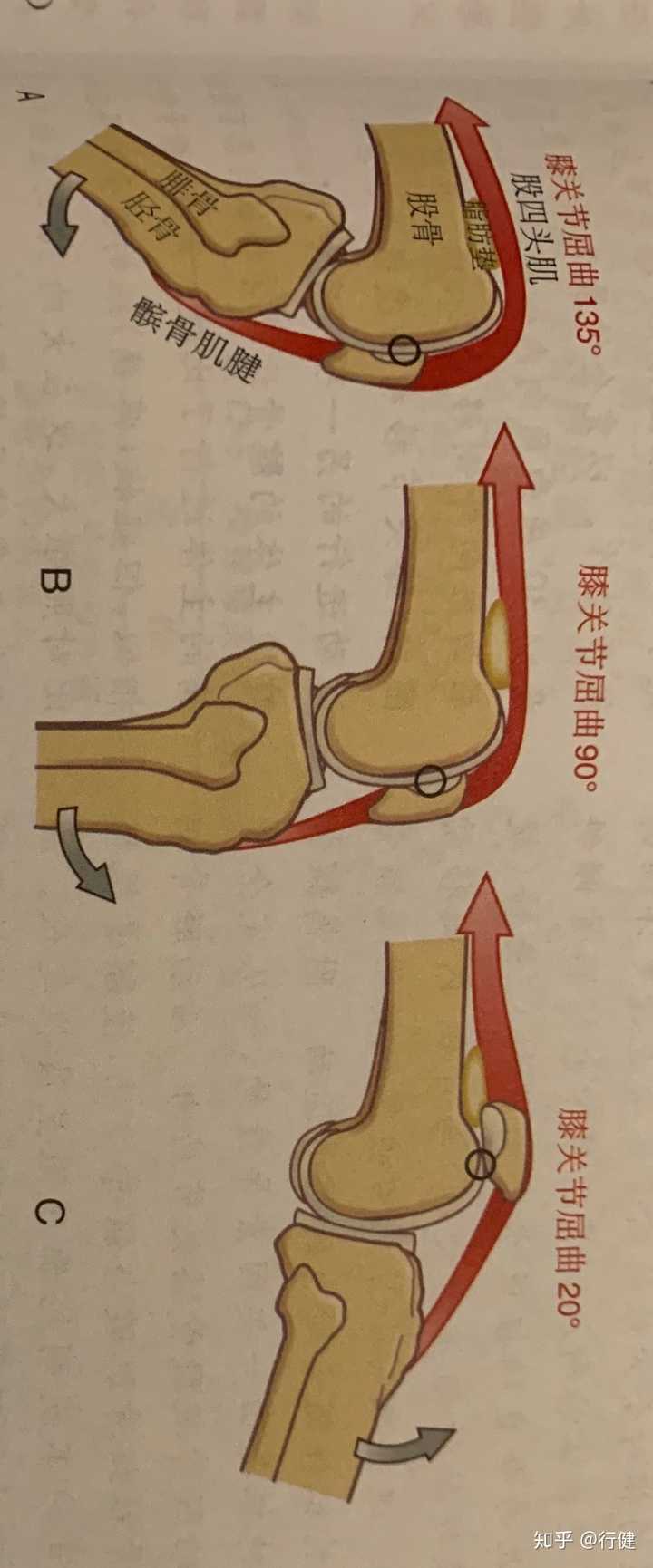 32岁膝关节退行性病变,怎样保养避免病情恶化?
