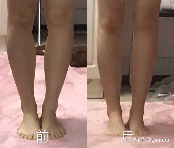 肌肉腿练女团腿美丽芭蕾真的会瘦吗?