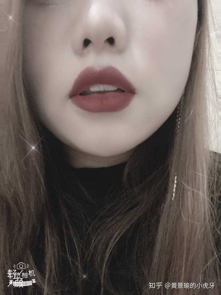有什么方法可以把嘴唇变薄,不用手术?