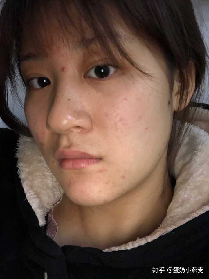 苹果前置摄像头拍摄下来的模样就是别人眼中我的样子吗?