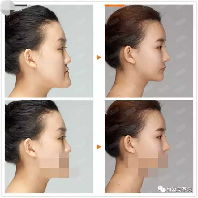 侧脸好不好看的评判标准到底是什么?