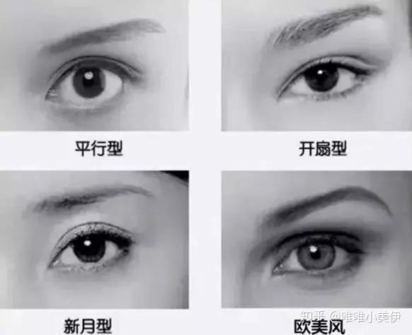 1,平行型双眼皮 双眼皮线与眼睛上眼睑线平行,前,中,后三个点宽度