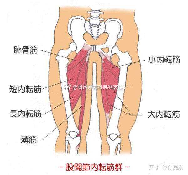 腹股沟(大腿根)疼痛的主要病种有