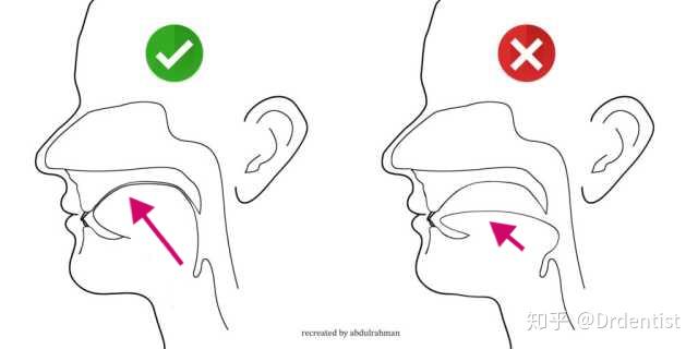 你们平时舌头是怎么放在嘴里的?