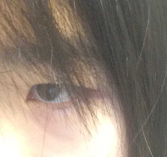 得了抑郁症的人眼神是不是都是一样的?