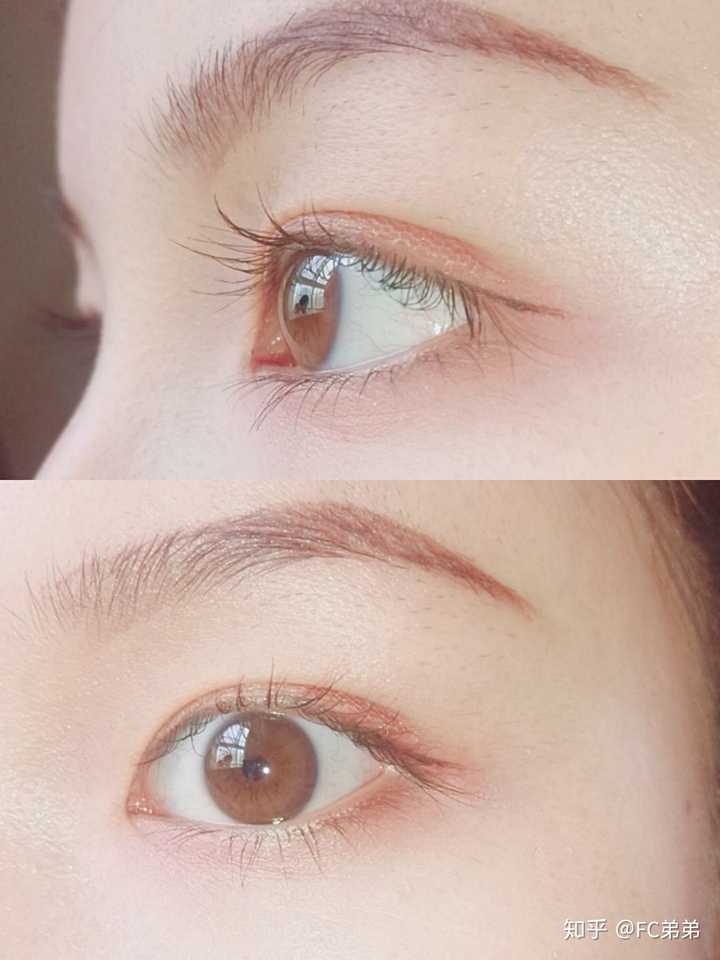 有什么方法可以让近视的眼睛变有神?