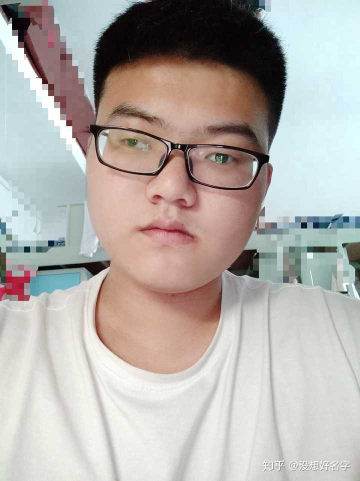 单眼失明是种怎样的体验?