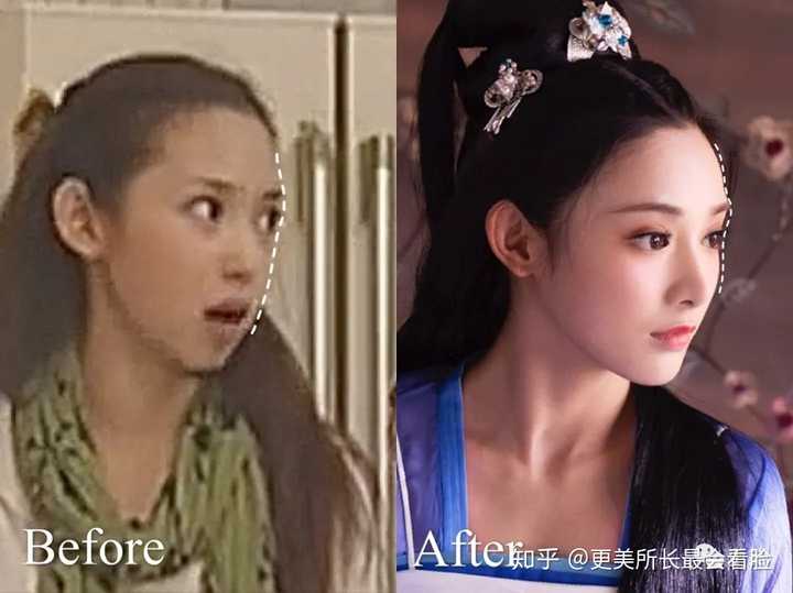 《东宫》女主彭小苒到底有没有整容 ?