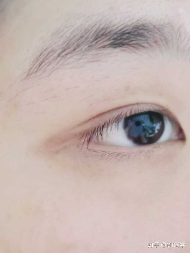 请问眼尾这部分构造是什么?