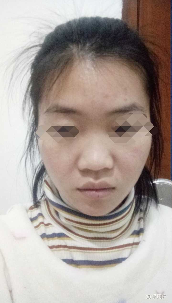 女生塌鼻子是一种什么体验?