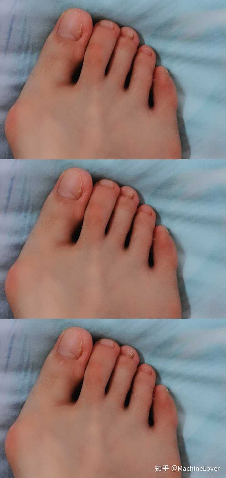 女生脚丑是种什么样的体验?