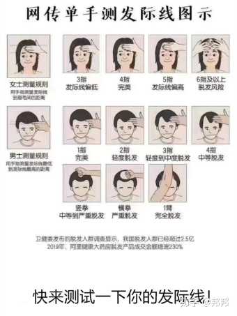 天生发际线高而且头发是软塌细的那种,怎么改善?