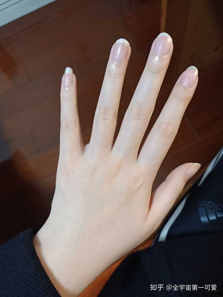 停止啃指甲之后,指甲能不能恢复正常?