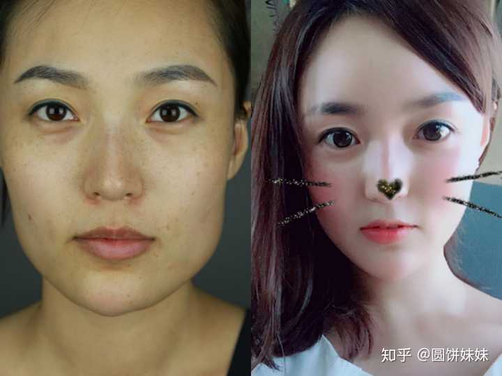 种子一号医生是首尔丽格的王牌医生,也是 下颌角长曲线截骨的发明者