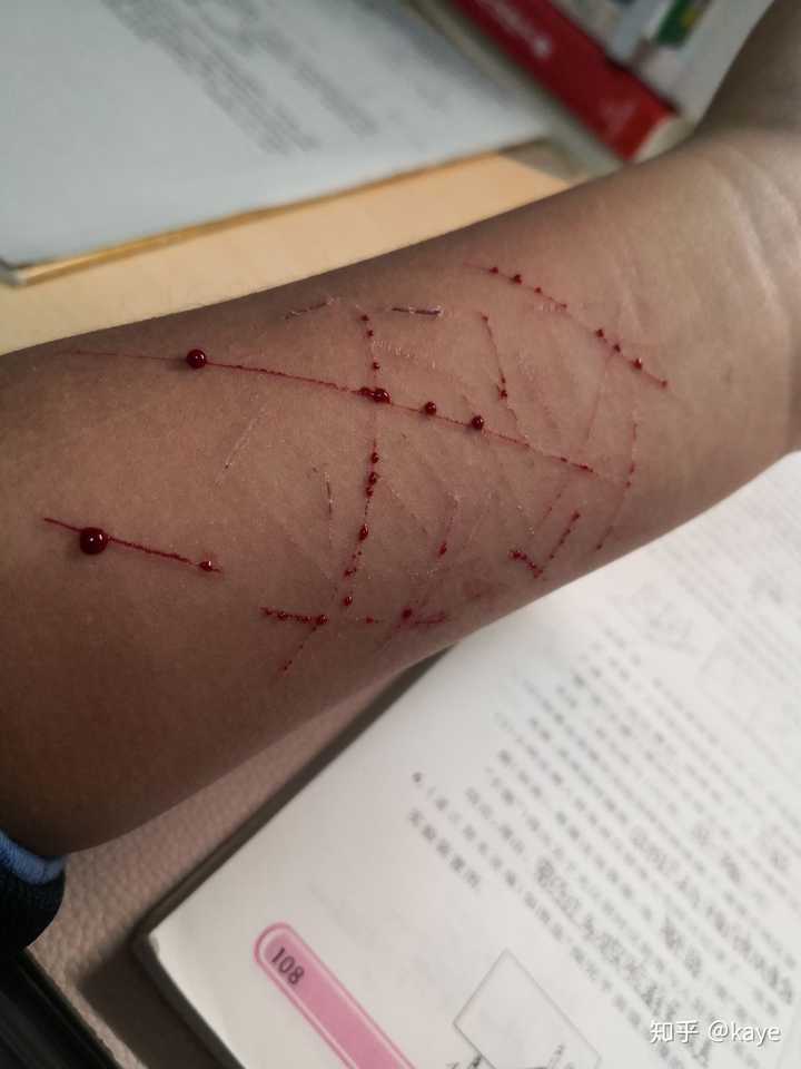 我也不知道 我是想让老师同学发现,至少找我聊聊吧 但是没有人发现