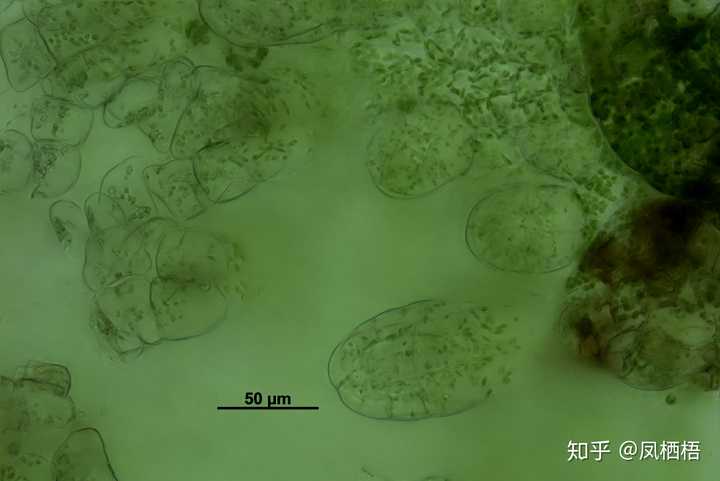 荚果蕨颈卵器