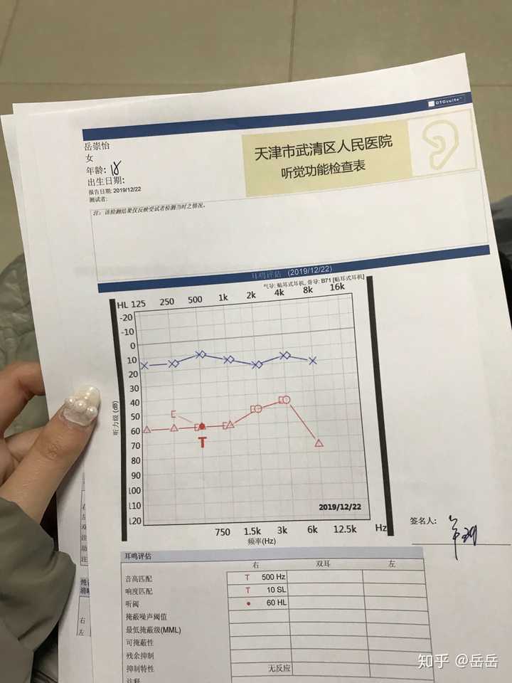 突发性耳聋,这个病治愈的可能性大吗?有必要住院吗?