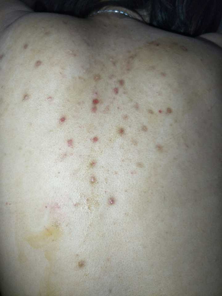 密集恐惧者慎看吧 感觉已经没救了