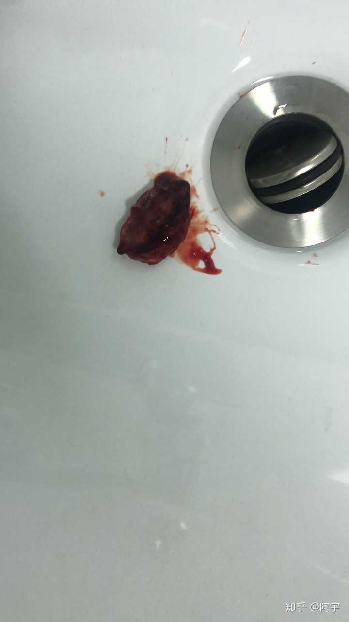 我满嘴鲜血打下这边知乎问答!本人亲身经历 足够说明了