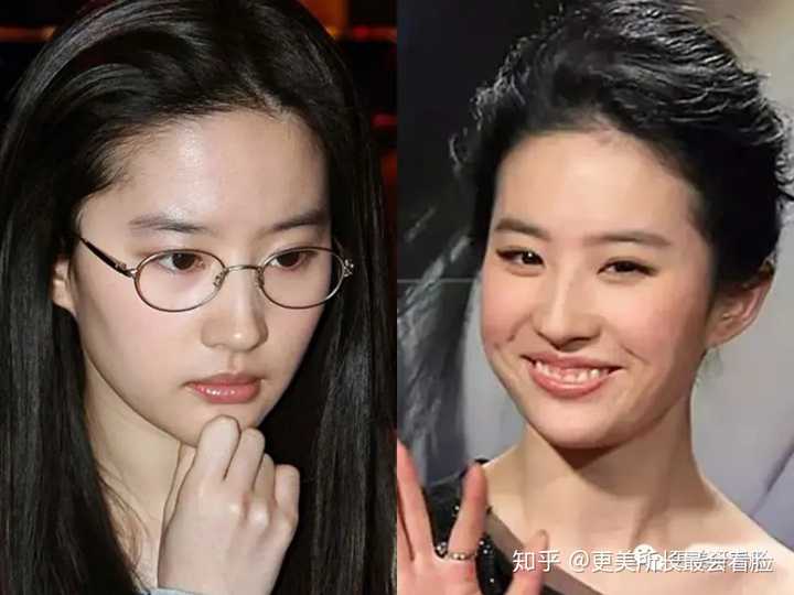(眉间,下巴坑坑洼洼,嘴周纹路也很多) 其实同样不适合做大表情的还有