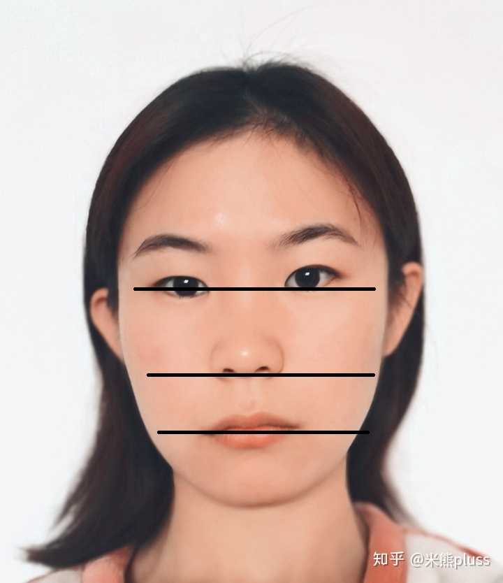 左右脸不对称,一边脸宽一边脸窄,面部肌肉松弛,能矫正
