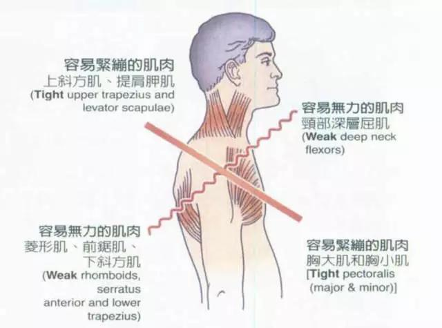 肩颈酸痛你们都是怎样解决疼痛的呢