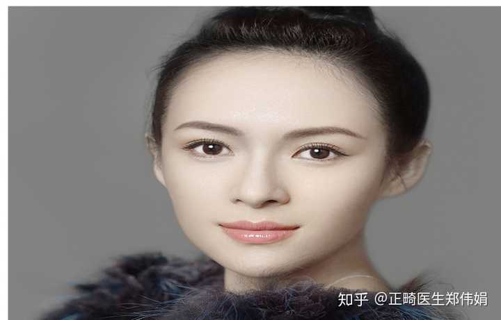 2,直面型---突面型---凹面型