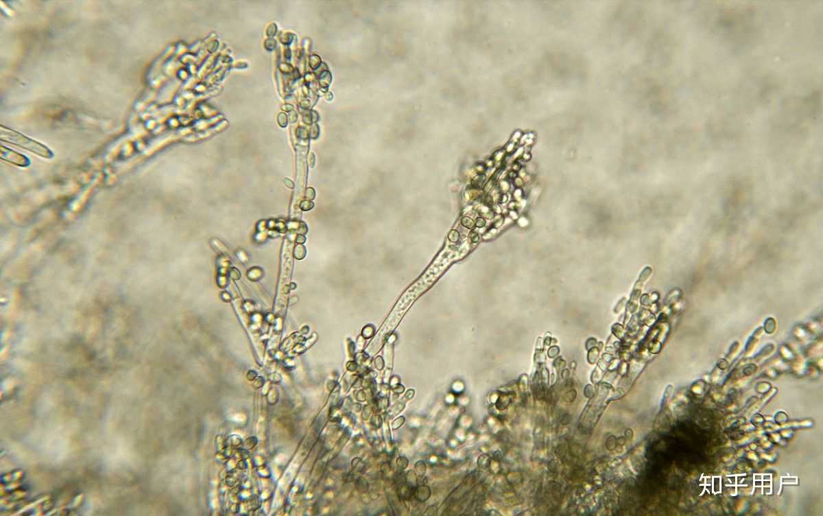 为什么我觉得很多显微镜下的微生物简直可以用美轮美奂形容呢?