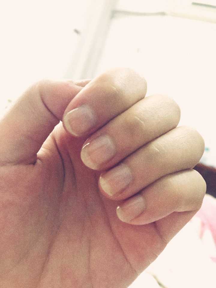 还经常咬出血,而且女孩子咬指甲真的很毁形象,不仅是人前不敢伸手