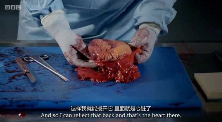 肥胖对人的生活有多大的影响?