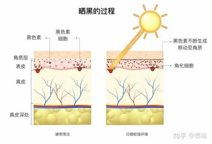 当黑色素转移到角质层,你就变黑了!