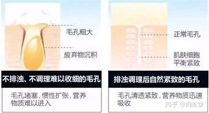 请问这个是不是真正的黑头?