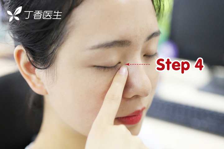同时用手指压按内眼角,这是为了防止药液顺着鼻泪管流入鼻腔,.