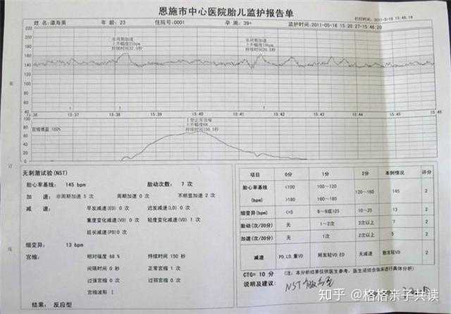 胎心监护是否有必要做?