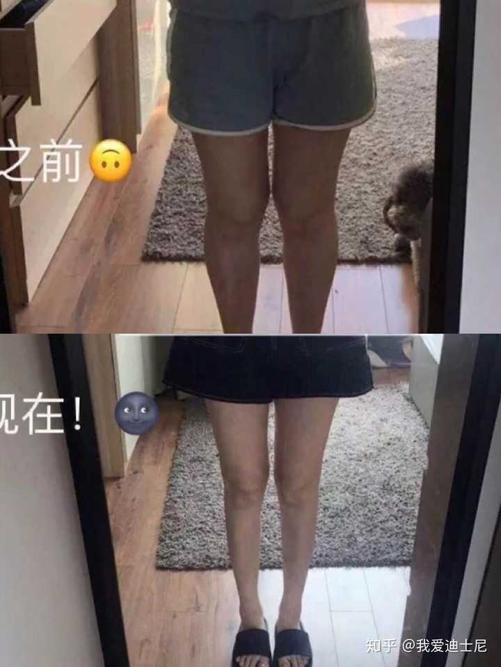 小腿粗上身很瘦想瘦腿怎么办?